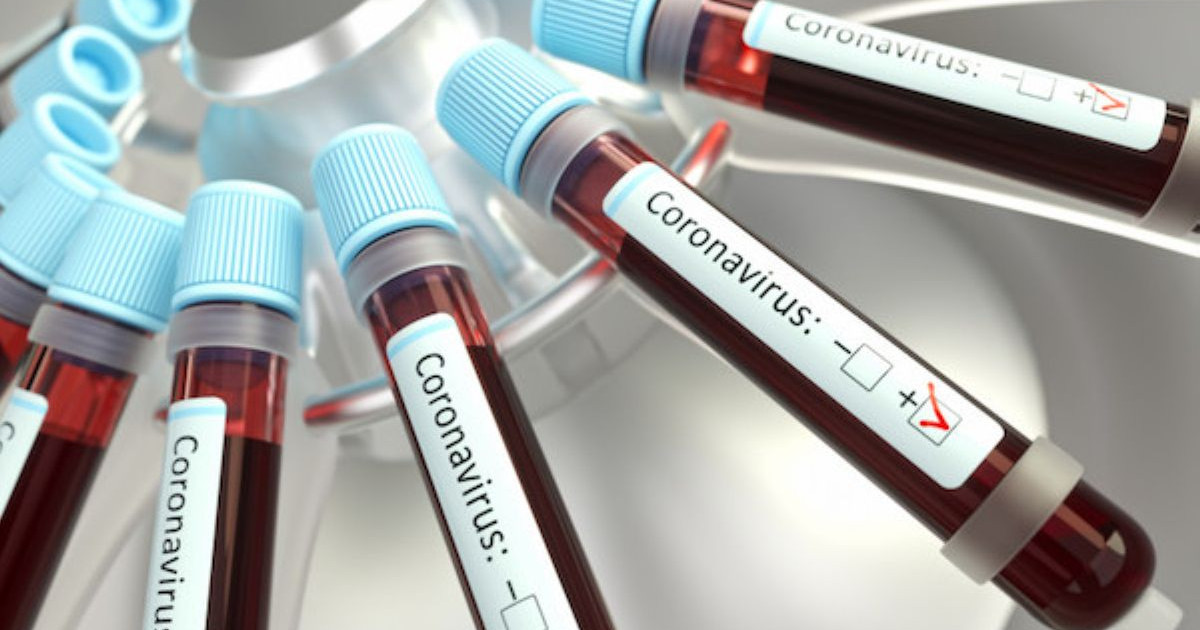COVID-19: Соңғы тіркелген 39 науқасқа қатысты деректер жарияланды