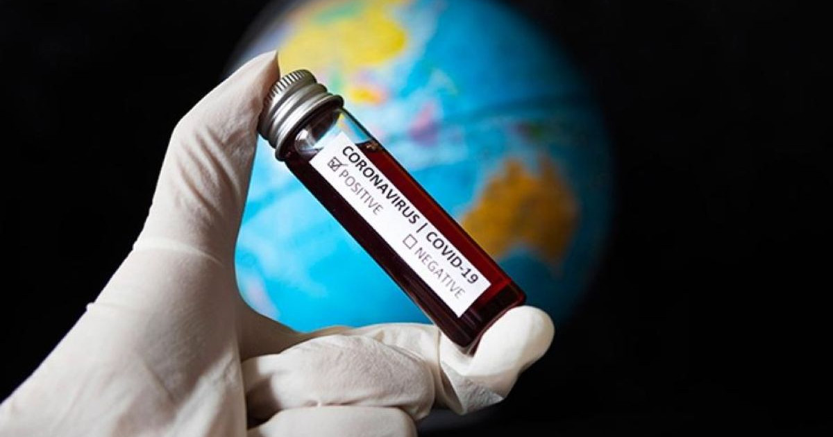 Әлемде коронавирус жұқтырғандар саны 15,4 миллионнан асып жығылды