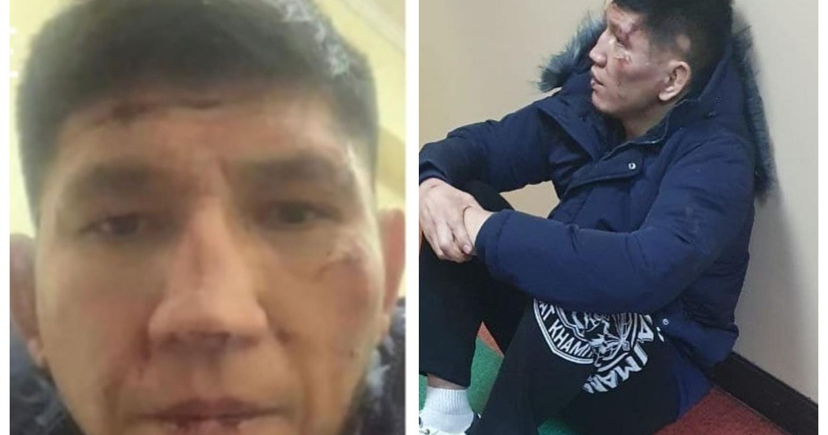 «Есін білмейді»: Қуат Хамитовтың қазіргі жағдайы белгілі болды
