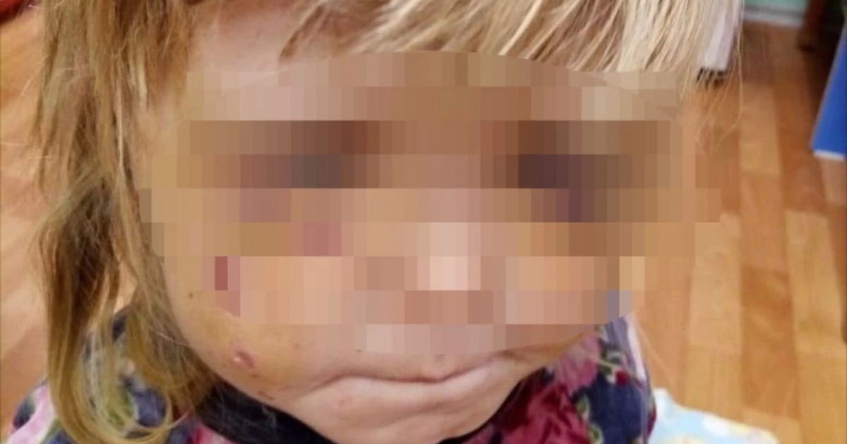 «Пышақ ала жүгірді»: Өскеменде Маугли секілді өмір сүрген қыздар құтқарылды