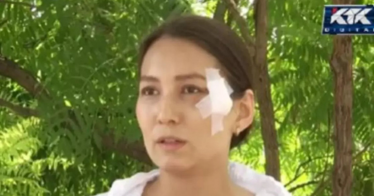 Пышақ жарақатын алған әйел бұрынғы күйеуінен қорқады