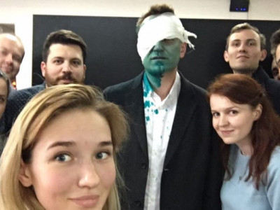 Навальныйдың бетіне белгісіз біреу улы зат шашып кетті