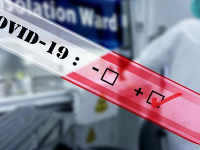 372 адамға жетті: Елімізде тағы 3 адамнан коронавирус анықталды