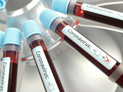 COVID-19: Соңғы тіркелген 39 науқасқа қатысты деректер жарияланды