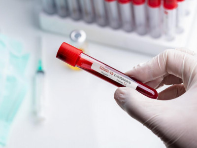 Өсім – 3,8%: Өткен тәулікте 265 адамнан коронавирус анықталды