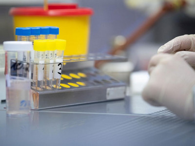 Өсім – 1,5%: Өткен тәулікте 183 адамнан коронавирус анықталды