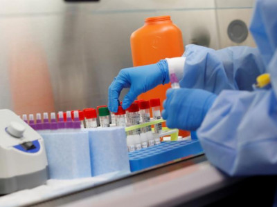 Елімізде өткен тәулікте 2054 адамнан коронавирус анықталды