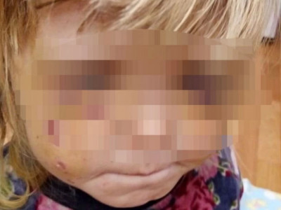 «Пышақ ала жүгірді»: Өскеменде Маугли секілді өмір сүрген қыздар құтқарылды