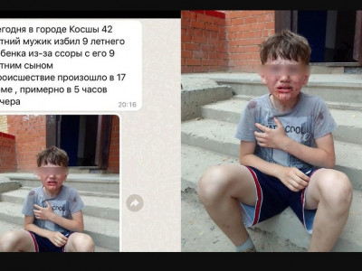 Тістерін түсірген: ер адам ұлымен төбелескен баланы соққыға жыққан