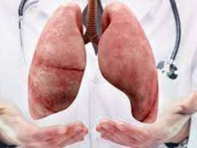 Қарағанды облысында балалар арасында өкпе ауруы өршіп тұр
