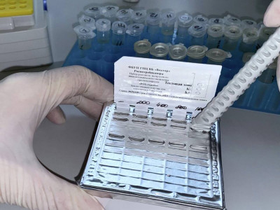 Ресей Қазақстанға маймыл шешегін анықтайтын тест жіберді