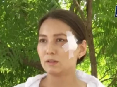 Пышақ жарақатын алған әйел бұрынғы күйеуінен қорқады