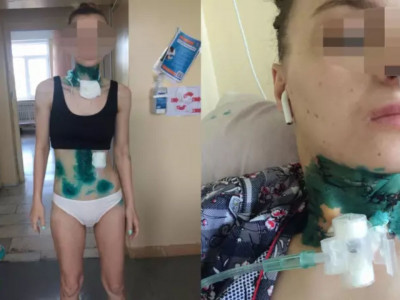 «Пышақтап өлтірмек болған»: күйеуінен қорлық көрген әйел әділдік іздейді