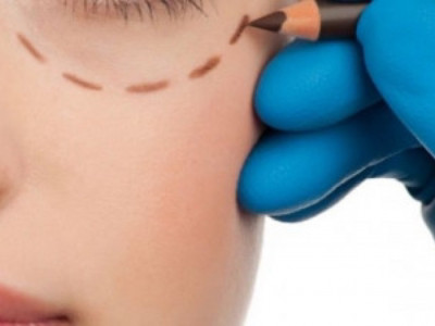 Өскеменде блефаропластика жасатуға барған әйел көз жұмды