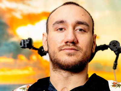 Миына чип орнатылған алғашқы адам қалай өмір сүріп жатқаны туралы айтып берді