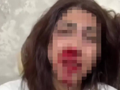 Алматыда балаларының көзінше бұрынғы әйелінің жағын сындырған күдікті ұсталды