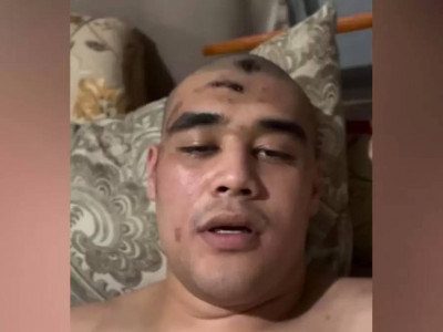 «Өміріме қауіп төніп тұрған соң…»: танымал боксшы өзін арнайы жасақ өкілдері соққыға жыққанын мәлімдеді