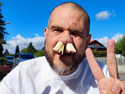 Балаларын қуантамын деп: Швеция тұрғыны мұрнына 81 шырпы тығып әлемдік рекорд орнатты