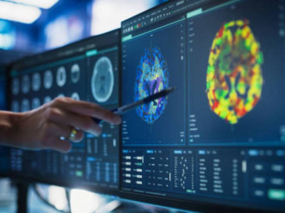 Қысқа видеолар миға қалай әсер етеді - зерттеу