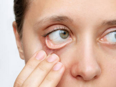 Темір тапшылығы тыныс жолдарын әлсірететіні анықталды