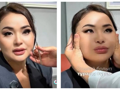 «Тұрсынбектен ұят болады»: Пластикалық ота жасататынын айтқан Мөлдір Мұқанова сынға қалды (ВИДЕО)