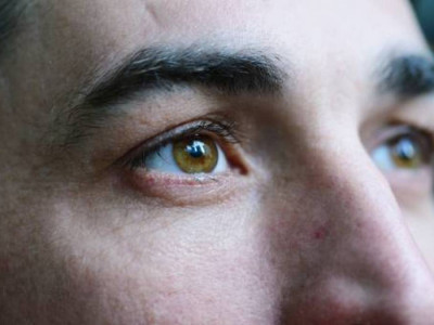 Холестериніңіз жоғары екенін көзге қарап анықтауға болады – дәрігер