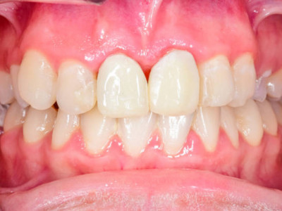 Ұйқыңыз дұрыс емес пе? – қызыл иегіңізді тексертіңіз