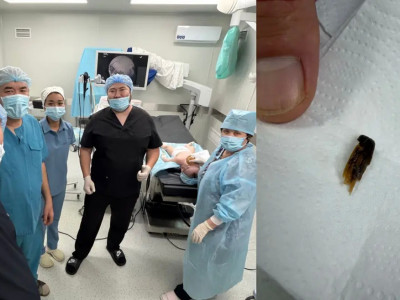 Ақтаулық дәрігерлер тыныс жолына бөгде зат тұрып қалған баланы құтқарды