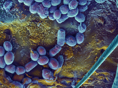 Ғалымдар қатерлі ісікті ішінен жеп жоятын бактерияларды сынақтан өткізіп жатыр