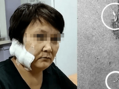 «Алты баланың анасы»: Шығыс Қазақстан тұрғыны бұрынғы әйелінің құлағын кесіп алған
