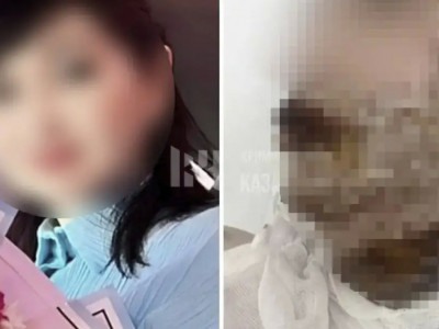 Шымкент тұрғыны бұрынғы әйелінің бетіне қышқыл шашып жіберген