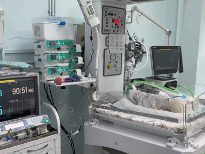 Алматыда дәрігерлер 679 грамм болып туған нәрестені аман алып қалды