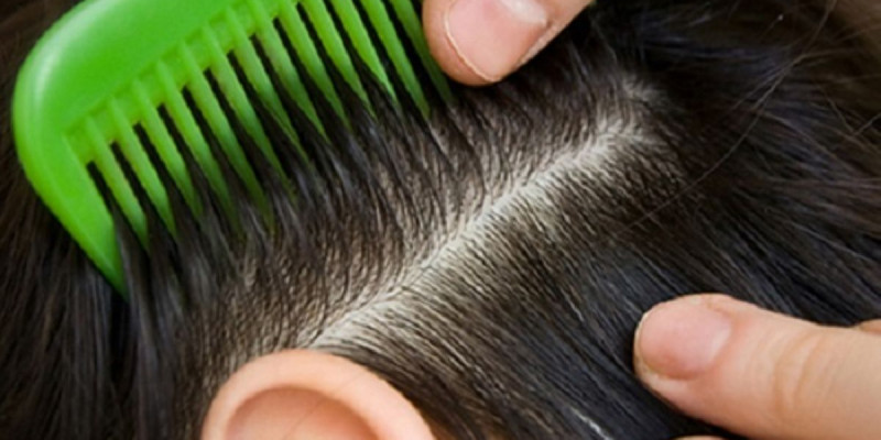 Оқушының басындағы битті керосинмен өлтірмек болған медбике жасөспірімді жазым ете жаздады