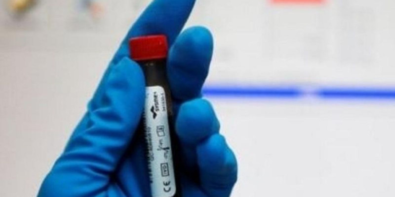 Дүниежүзілік допингке қарсы агенттік Алматыдағы зертхана жұмысын тоқтатты