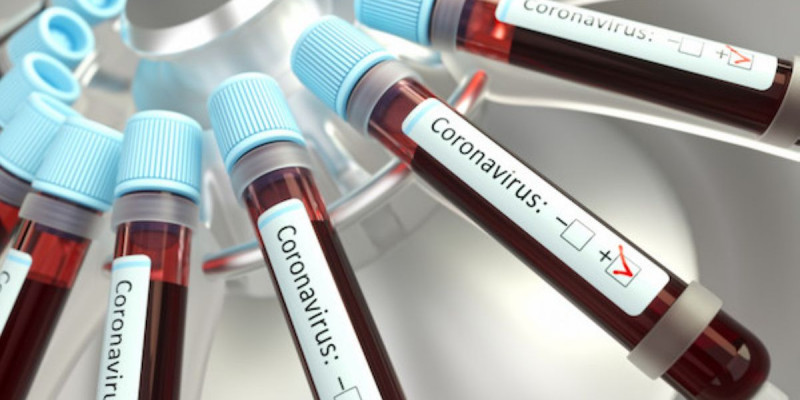COVID-19: Соңғы тіркелген 39 науқасқа қатысты деректер жарияланды