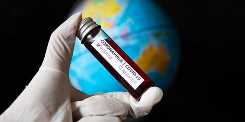 Әлемде коронавирус жұқтырғандар саны 15,4 миллионнан асып жығылды