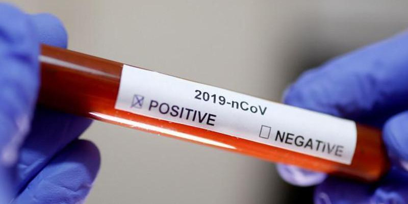 Елімізде коронавирус жұқтырғандар саны 105,8 мыңға жуықтады
