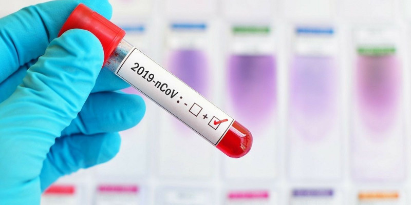 COVID-19: Өткен тәулікте Қазақстанда қанша науқас тіркелгені белгілі болды