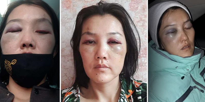 Нұр-Сұлтанда бұрынғы күйеуі сіңлісі екеуін ұрып-соққан әйел Үкіметтен көмек сұрады