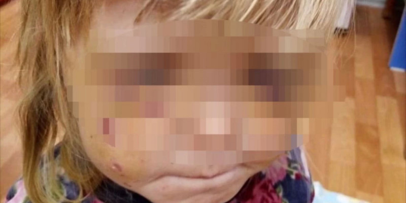 «Пышақ ала жүгірді»: Өскеменде Маугли секілді өмір сүрген қыздар құтқарылды