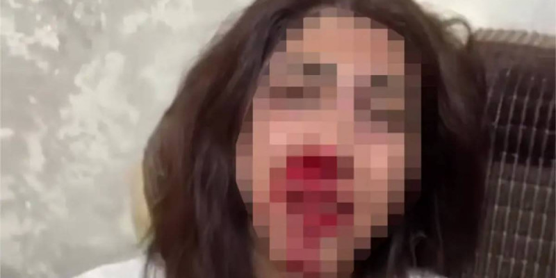 Алматыда балаларының көзінше бұрынғы әйелінің жағын сындырған күдікті ұсталды