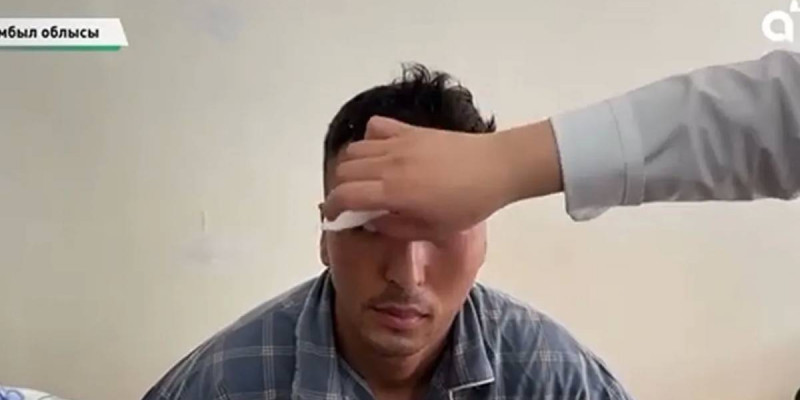 Жамбыл облысында әскери қызметкер басына бөтелке жарам деп жанарын жарақаттады