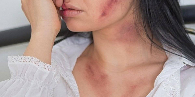 Шымкентте сүйіктісінің жағын сындырған жігіт сотталды