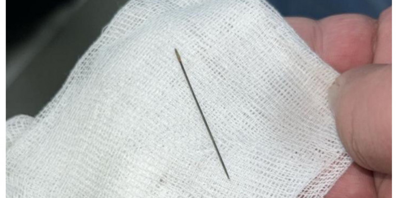 Түркістанда 8 айлық сәбидің ішкі құрылысынан ине табылды