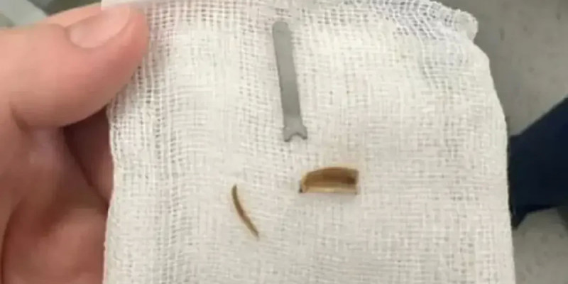 Ақтауда 11 айлық сәбидің өкпесінен металл табылды