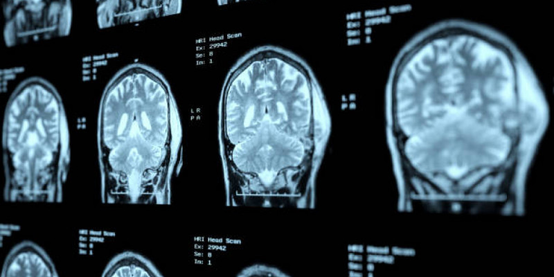 Деменция қаупін едәуір төмендететін қарапайым әдет аталды