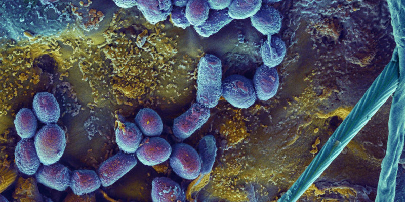 Ғалымдар қатерлі ісікті ішінен жеп жоятын бактерияларды сынақтан өткізіп жатыр