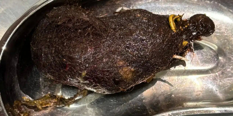 Алматыда шашын жей беретін 12 жастағы қыздың асқазанына ота жасалды