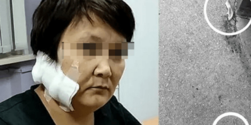 «Алты баланың анасы»: Шығыс Қазақстан тұрғыны бұрынғы әйелінің құлағын кесіп алған