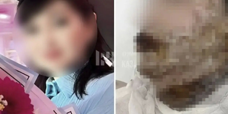 Шымкент тұрғыны бұрынғы әйелінің бетіне қышқыл шашып жіберген